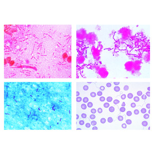 LIEDER Bacterias como causa de enfermedades y epidemias 25 prep.