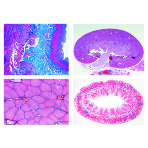 LIEDER Series for Secondary Schools, Set No. II. Metabolism, 15 microscope slides