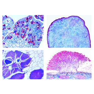 LIEDER Agriculture (Parasitic Fungi), 20 microscope slides