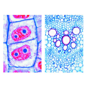 LIEDER Cellule végétale (cytologie), base (6 préparations), kit étudiant