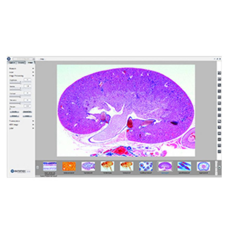 Euromex Camera CMEX_5, 5MP, 1/2.5" CMOS, USB 2.0