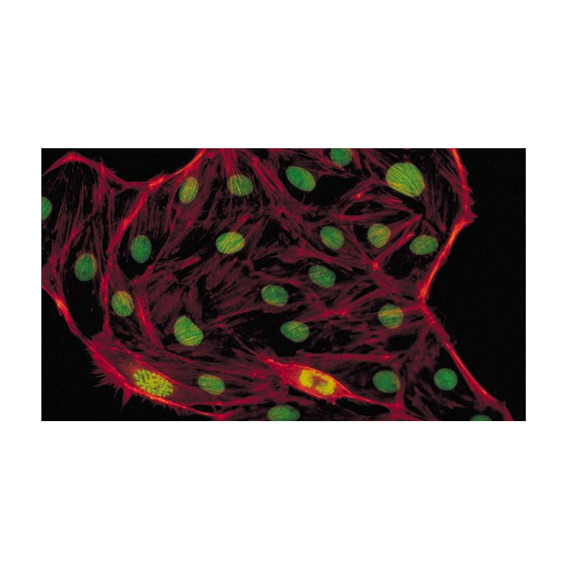 Microscope Evident Olympus CX41 fluorescence, trino, 40x,100x, 400x