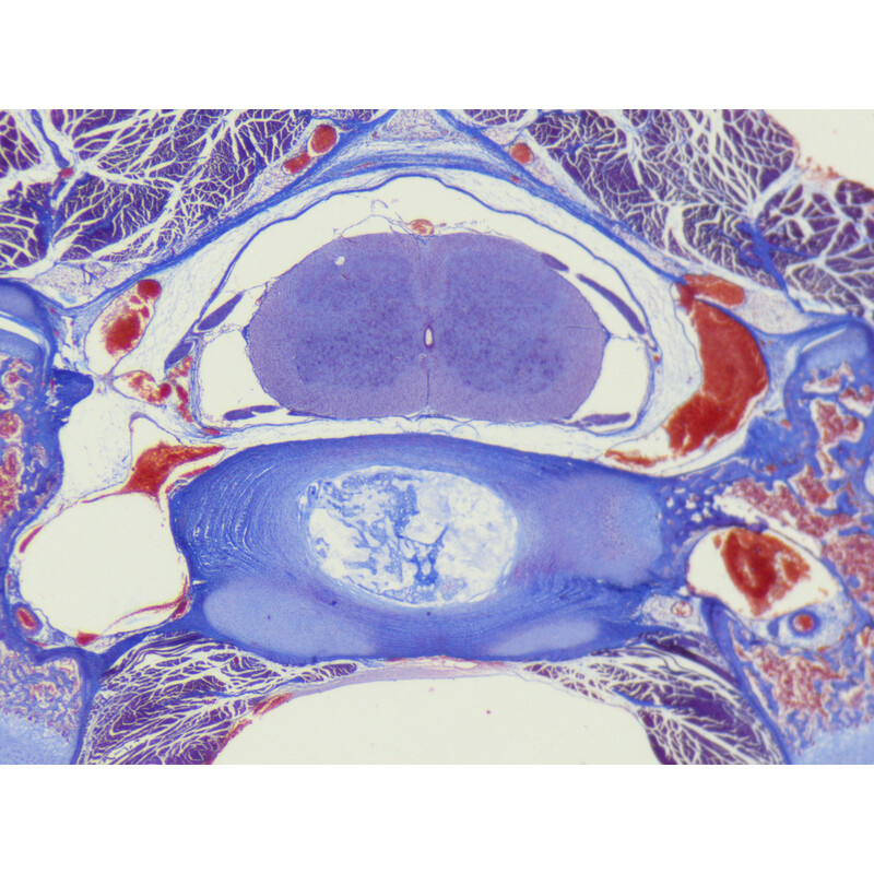 ZEISS Microscopio stereo zoom Stemi 355, C Lab, trino, BF, DF, distancia de trabajo 110 mm, 10x/23, 5,5:1, 7,2x-40x, AL/DL, Spot C LED